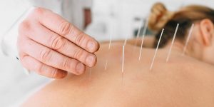 acupuntura, Asa Norte, Brasília, equilíbrio energético, alívio de dores, bem-estar, saúde